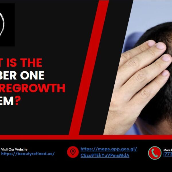 What Is the Number One Hair Regrowth System?