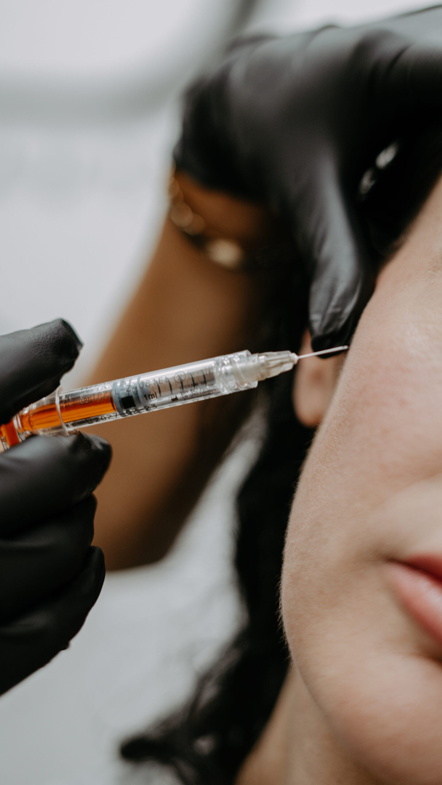 Premium Dermal Fillers image 0