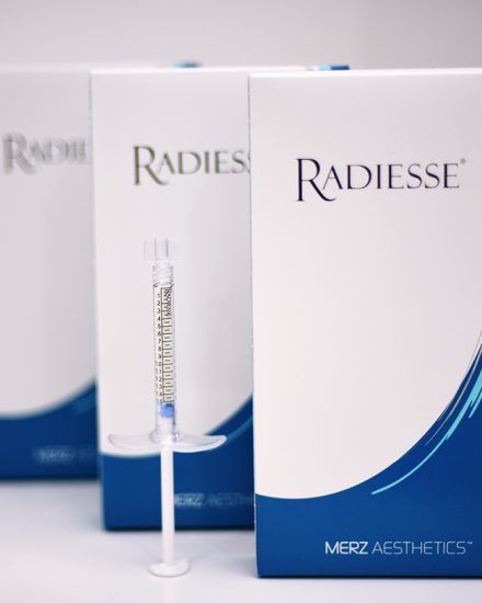 Radiesse Filler image 4