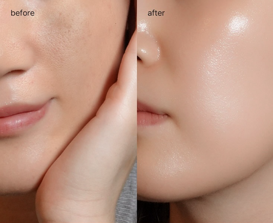 Skin Boosters image 0